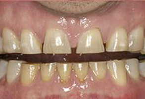 Before treatment case 8